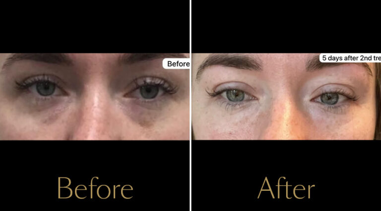 rakus-polyphil-gallery6