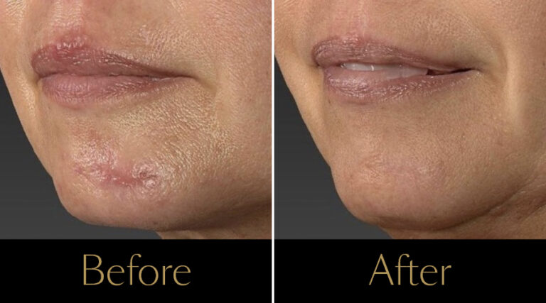 rakus-polyphil-gallery7