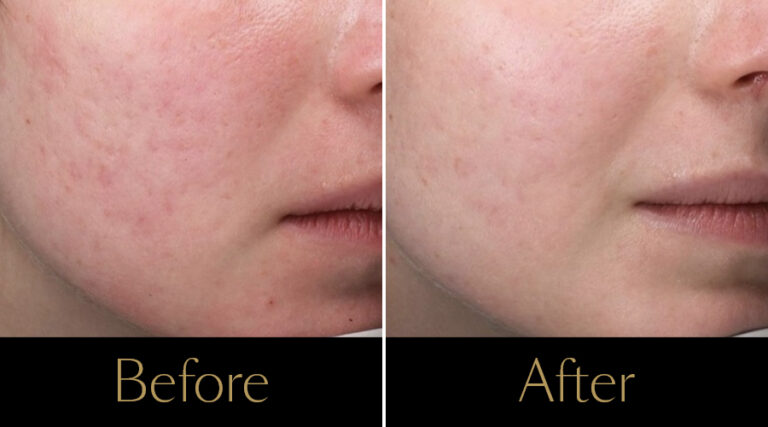 rakus-polyphil-gallery8