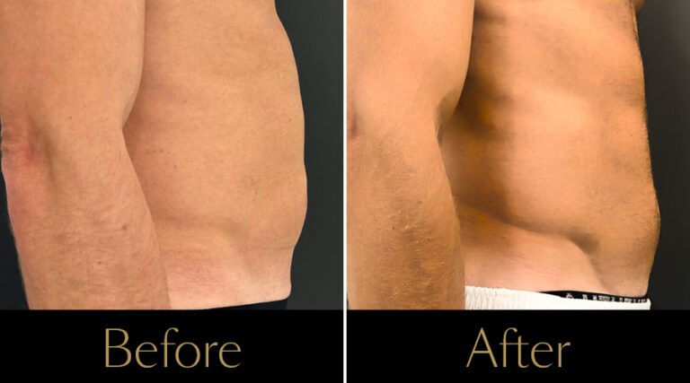 rakus-pureimpact-gallery