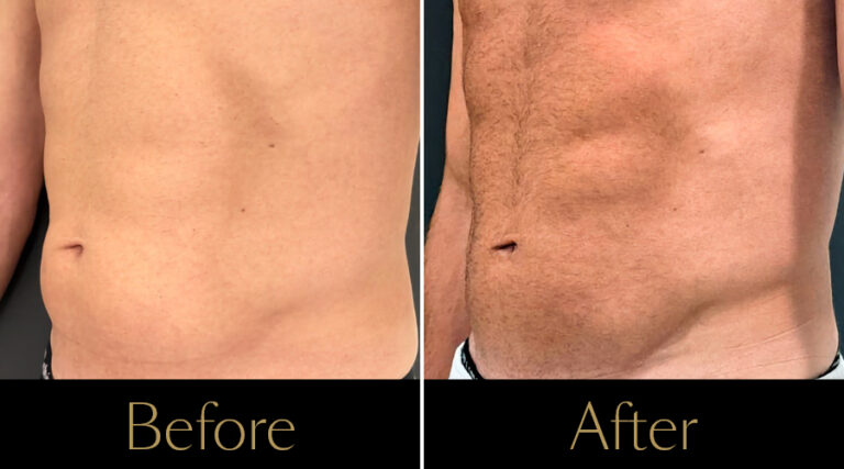 rakus-pureimpact-gallery2