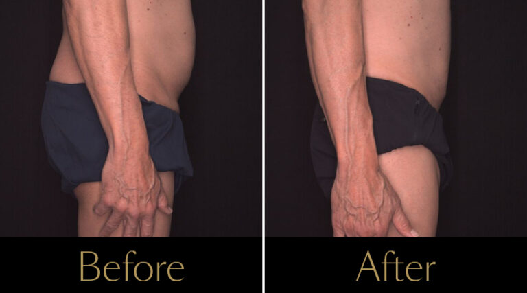 rakus-pureimpact-gallery3