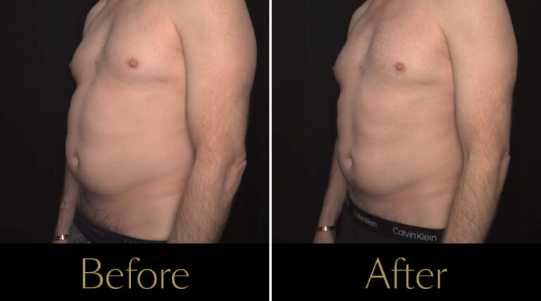 rakus-pureimpact-gallery4