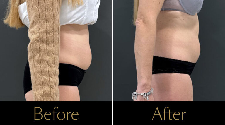 rakus-pureimpact-gallery6