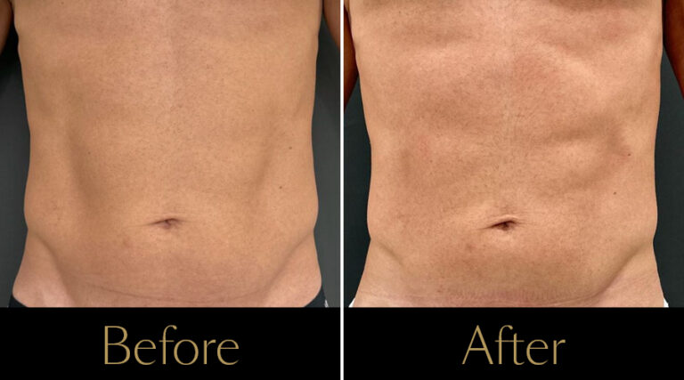 rakus-pureimpact-gallery7