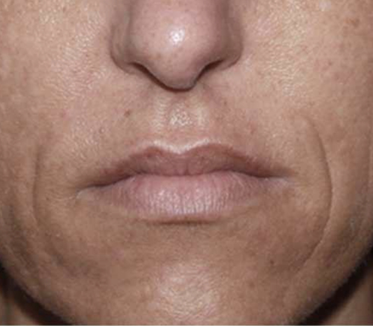 rakus-secret-beforeafter5