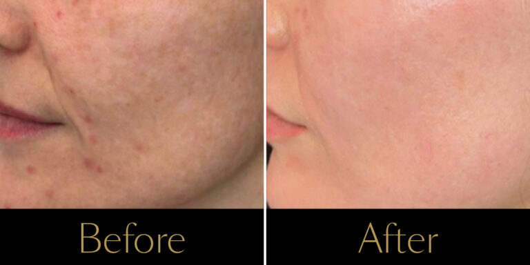 rakus-secret-gallery