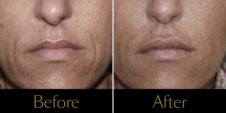 rakus-secret-gallery2