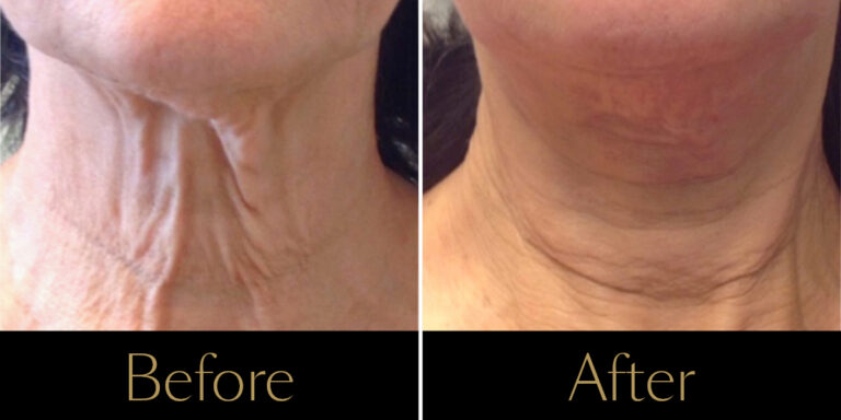 rakus-secret-gallery3