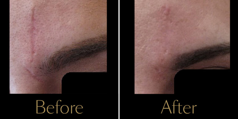 rakus-secret-gallery4