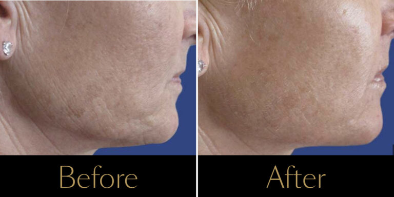 rakus-secret-gallery7