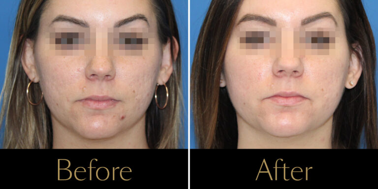 rakus-secret-gallery8