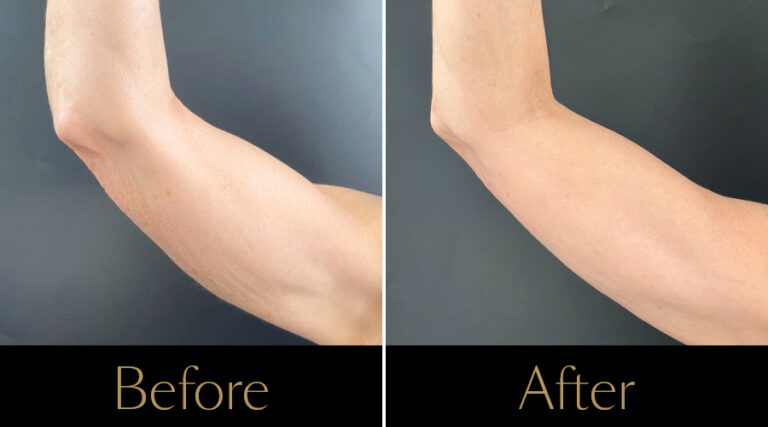 rakus-sofwave-gallery2