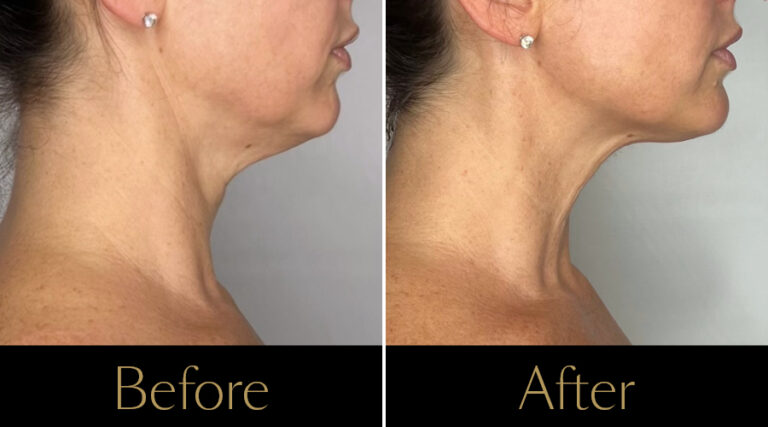 rakus-sofwave-gallery3