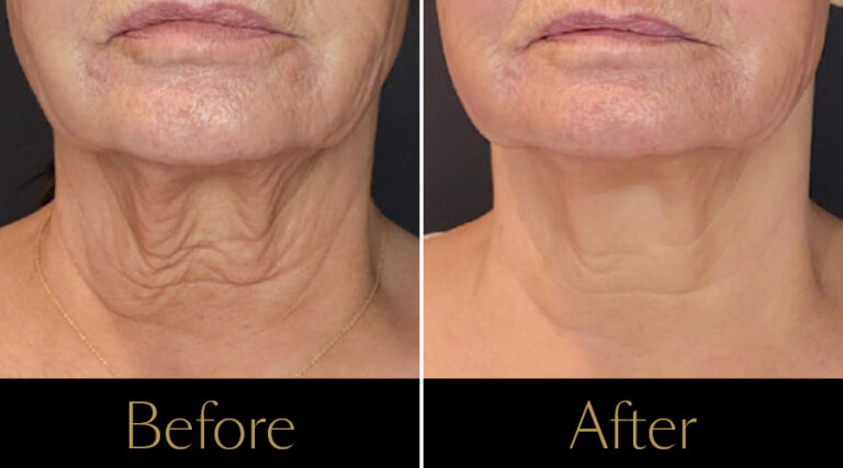 rakus-sofwave-gallery4