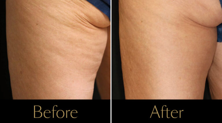 rakus-sofwave-gallery5