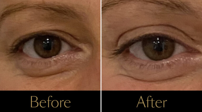 rakus-sofwave-gallery6