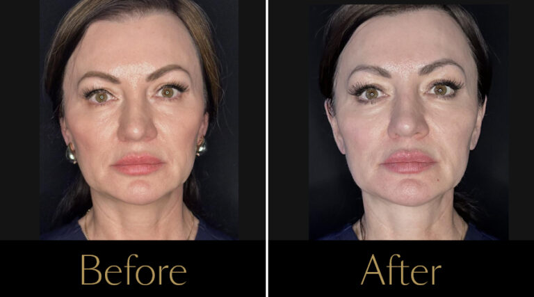 rakus-sofwave-gallery7