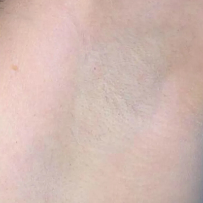 rakus-soprano-beforeafter2