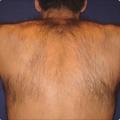 rakus-soprano-beforeafter3