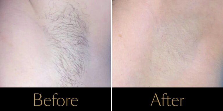 rakus-soprano-gallert2