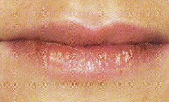 RR_lips_after