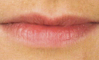 RR_lips_before
