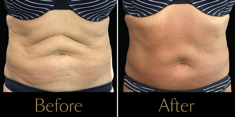 Rakus-Exilis-Gallery