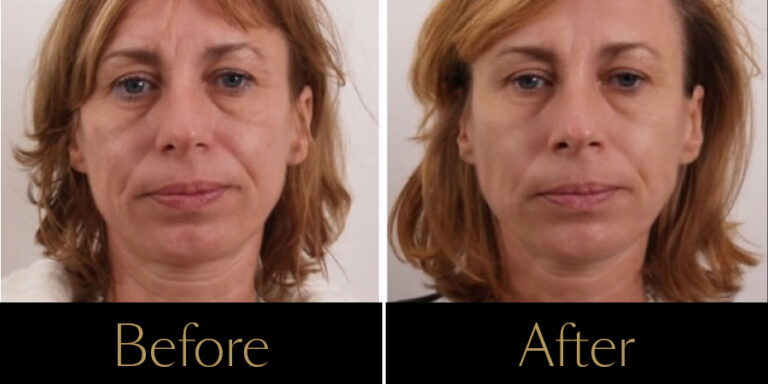 Rakus-Exilis-Gallery10