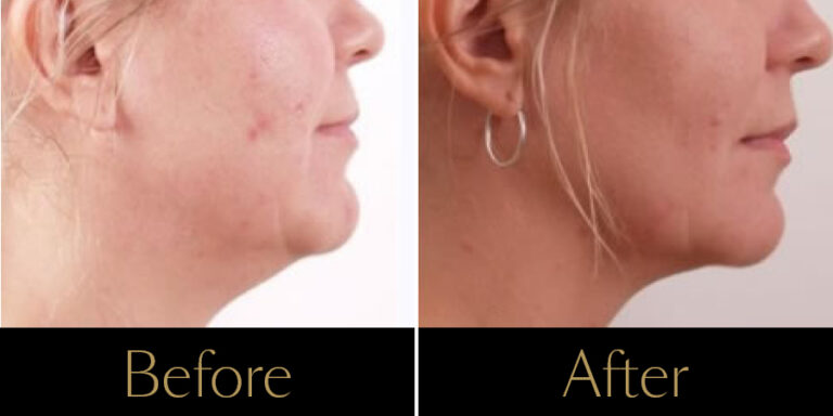 Rakus-Exilis-Gallery11