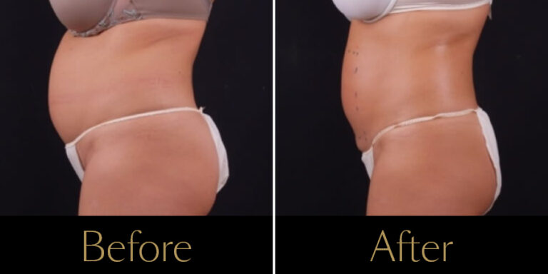 Rakus-Exilis-Gallery12