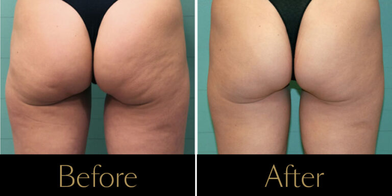 Rakus-Exilis-Gallery13