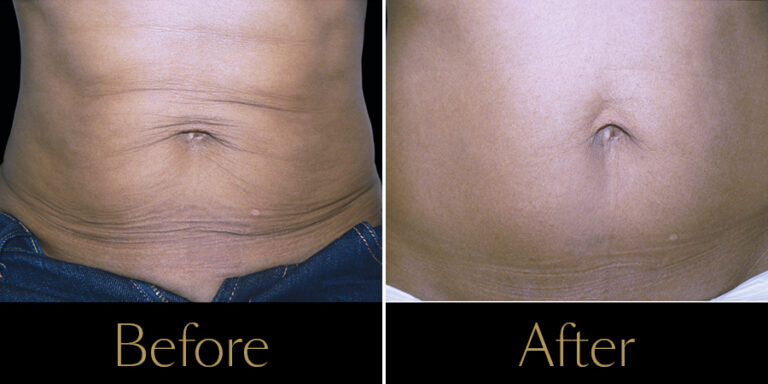 Rakus-Exilis-Gallery2