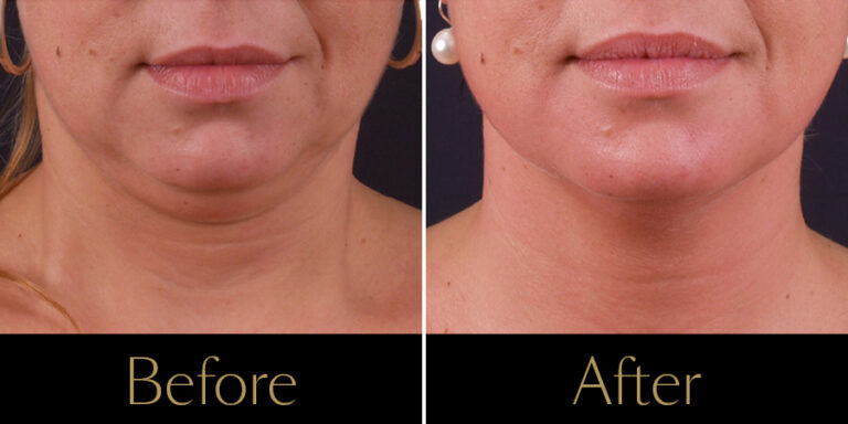 Rakus-Exilis-Gallery3