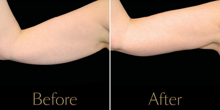 Rakus-Exilis-Gallery4