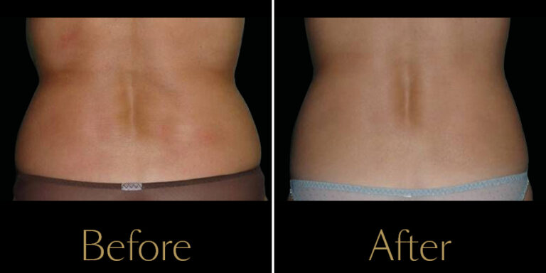 Rakus-Exilis-Gallery5