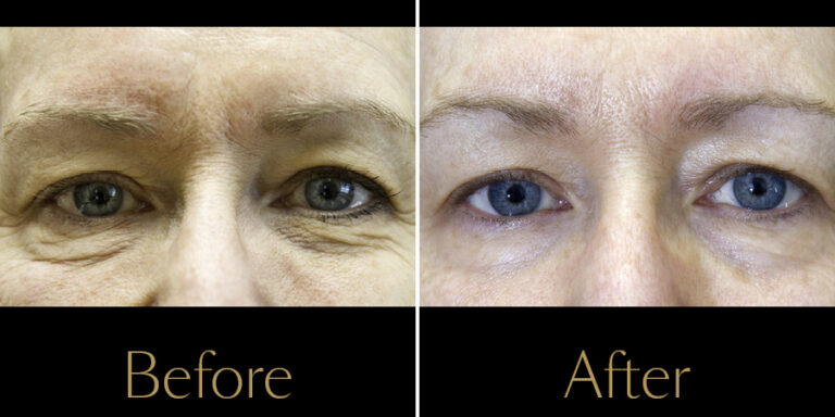 Rakus-Exilis-Gallery6