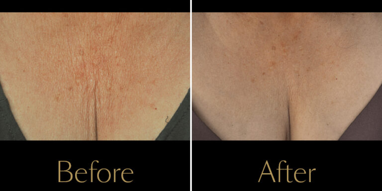 Rakus-Exilis-Gallery7