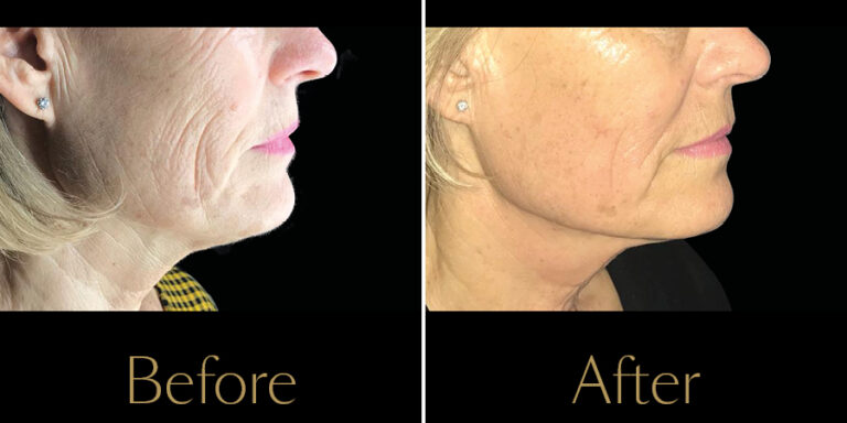 Rakus-Exilis-Gallery8