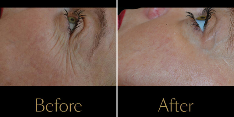 Rakus-Exilis-Gallery9