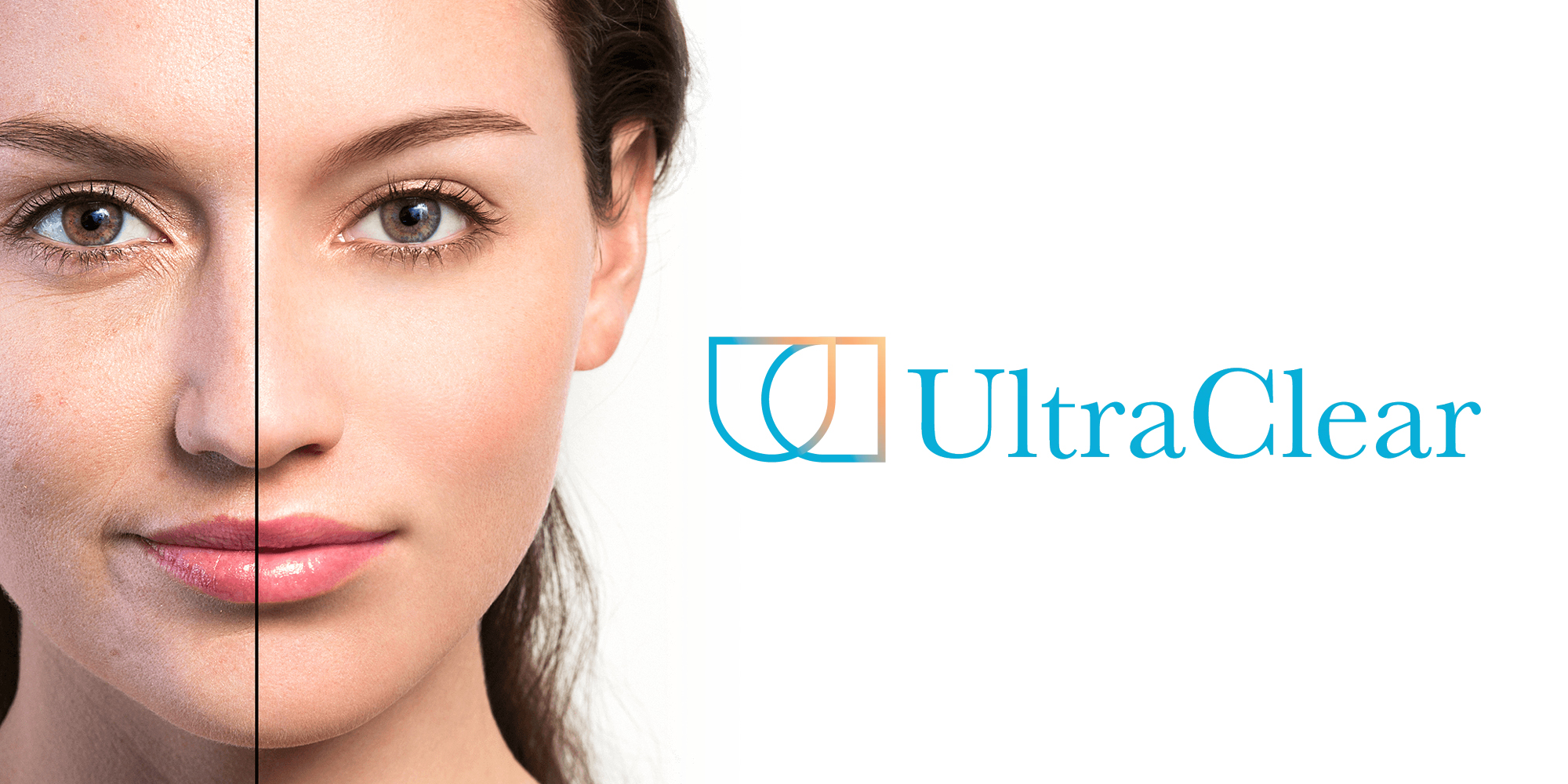 Web-banners-1-Rakus-Clinic-ultraclear