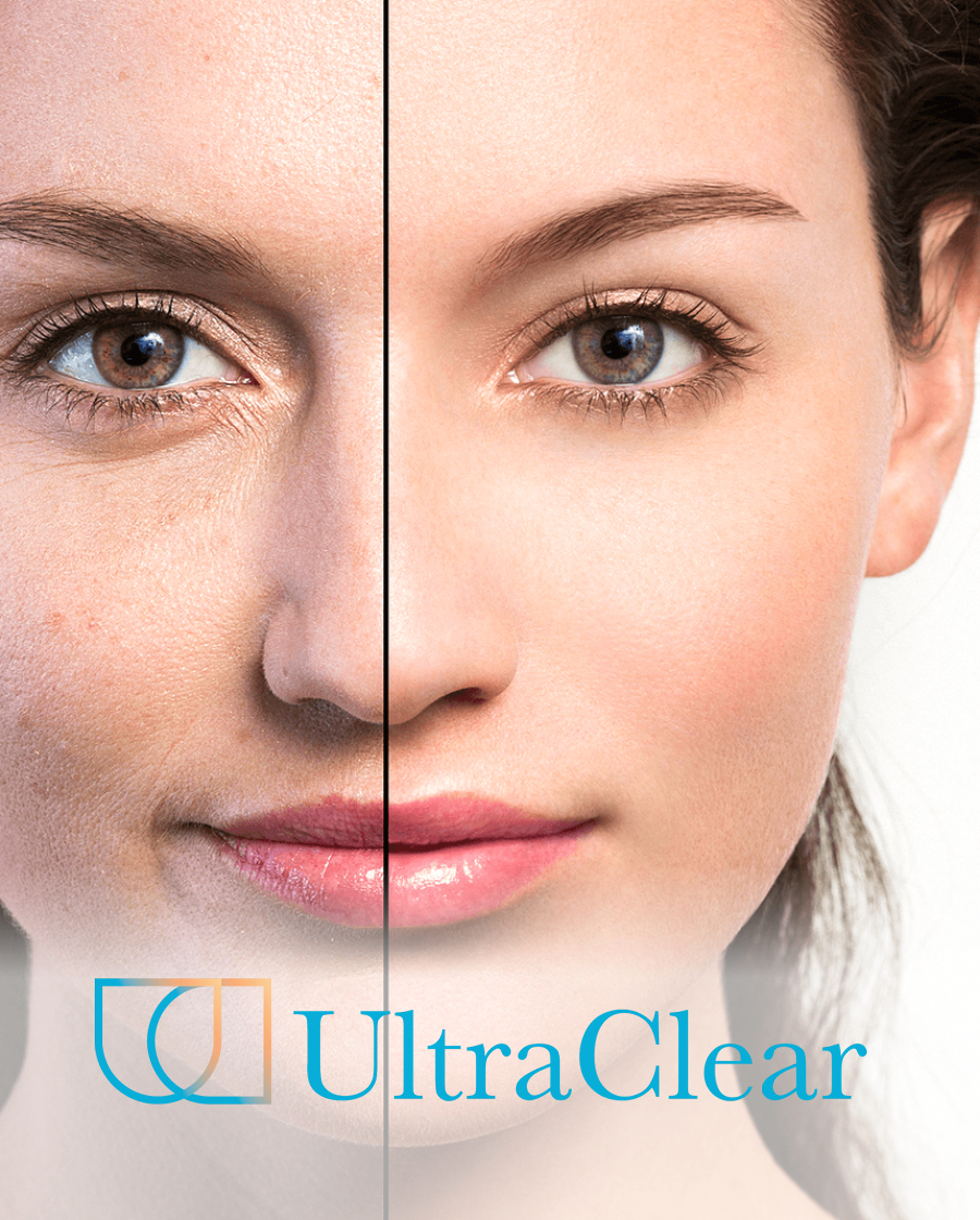 Web-banners-1-Rakus-Clinic-ultraclear2
