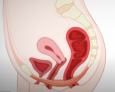 rakus-empower-rf-gallery