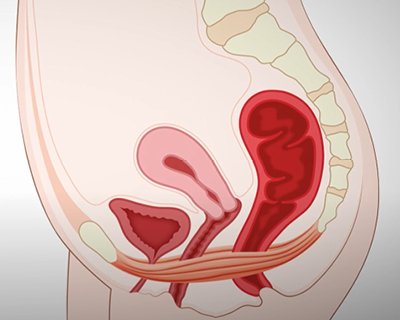 rakus-empower-rf-gallery2