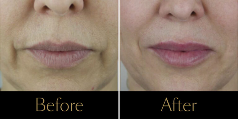 rr-ba-revitalis-gallery2