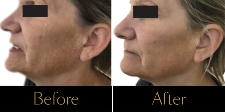 rr-ba-revitalis-gallery3